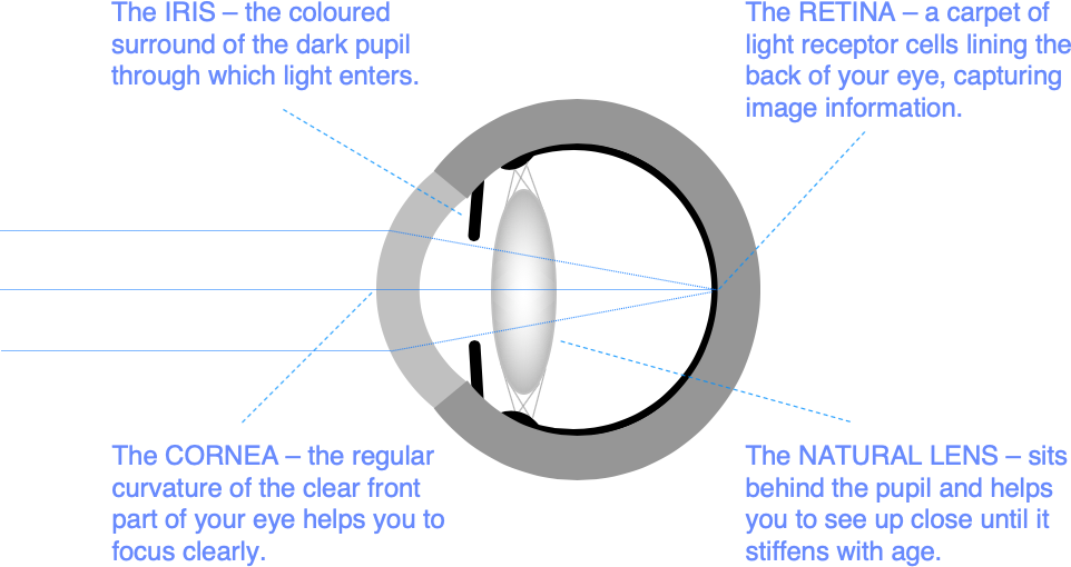 varifocals and astigmatism